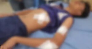 दो छात्रों के बीच हाथापाई हुई। झगड़े के दौरान एक छात्र ने दूसरे छात्र के पेट में कैंची मार दी।