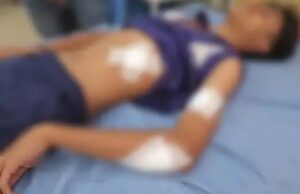 दो छात्रों के बीच हाथापाई हुई। झगड़े के दौरान एक छात्र ने दूसरे छात्र के पेट में कैंची मार दी।